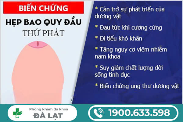 Hình ảnh minh họa